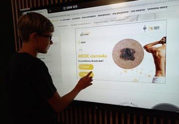 Program profilaktyki czerniaka skóry – „Znamię! Znam je?”